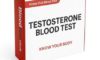 Testosterone Blood Test: A Sheffield Resident’s Guide
