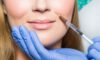 Lip Filler Simulation for Your Ideal Aesthetic Transformation
