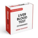 Liver Blood Test: Essential for Residents of Plymouth